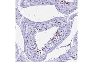 Immunohistochemical staining of human testis with PATE4 polyclonal antibody  shows strong cytoplasmic positivity in cells in seminiferus ducts at 1:50-1:200 dilution.