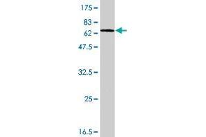 Western Blot detection against Immunogen (68. (AGO2 antibody  (AA 1-377))