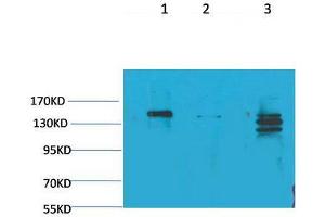 Western Blot (WB) analysis of 1) Rat Brain Tissue, 2)Mouse Brain Tissue, 3) HeLa with SLC12A4 Rabbit Polyclonal Antibody diluted at 1:2000. (SLC12A4 antibody)