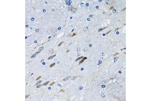 Immunohistochemistry of paraffin-embedded mouse brain using BLZF1 antibody (ABIN2561429) at dilution of 1:100 (40x lens). (BLZF1 antibody)