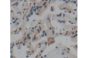 Figure. (LGI3 antibody  (AA 261-548))