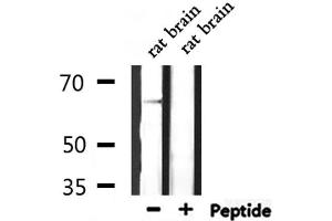 Western blot analysis of extracts from rat brain, using SLC6A1 Antibody. (SLC6A1 antibody  (Internal Region))