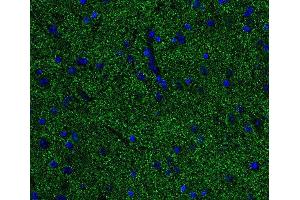 Indirect immunostaining of PFA fixed paraffin embedded mouse spinal cord section (dilution 1 : 500; green). (Alpha, beta Synuclein antibody)