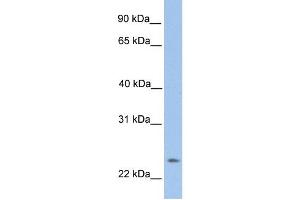 ORAI1 antibody used at 1 ug/ml to detect target protein. (ORAI1 antibody  (N-Term))