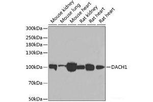 Western blot analysis of extracts of various cell lines using DACH1 Polyclonal Antibody at dilution of 1:1000. (DACH1 antibody)