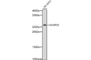 Western blot analysis of extracts of SH-SY5Y cells, using SN antibody (ABIN3021231, ABIN3021232, ABIN3021233 and ABIN6214078) at 1:1000 dilution.