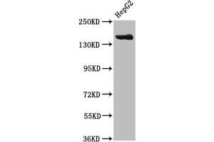 Western Blot Positive WB detected in: HepG2 whole cell lysate All lanes: CPS1 antibody at 3. (CPS1 antibody  (AA 1361-1500))