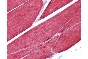 IHC-P Image Immunohistochemical analysis of paraffin-embedded human skeletal muscle, using alpha Actin (skeletal muscle), antibody(10 μg/ml). (Actin antibody)