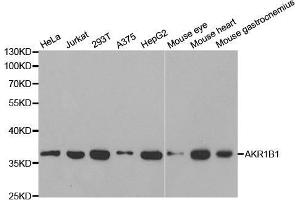 Western blot analysis of extracts of various cell lines, using AKR1B1 antibody. (AKR1B1 antibody  (AA 1-316))