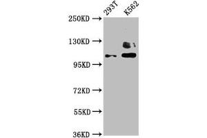 Western Blot Positive WB detected in: 293T whole cell lysate, K562 whole cell lysate All lanes: ZNF268 antibody at 4 μg/mL Secondary Goat polyclonal to rabbit IgG at 1/50000 dilution Predicted band size: 109, 90, 10, 12, 16, 6, 13 kDa Observed band size: 109 kDa (ZNF268 antibody  (AA 416-603))