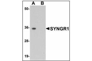 Western blot analysis of SYNGR1 in rat brain tissue lysate with SYNGR1 antibody at 1 µg/ml in (A) the absence and (B) the presence of blocking peptide.