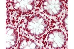 Immunohistochemistry (Paraffin-embedded Sections) (IHC (p)) image for anti-SWI/SNF Related, Matrix Associated, Actin Dependent Regulator of Chromatin, Subfamily E, Member 1 (SMARCE1) (AA 39-88) antibody (ABIN6756607)