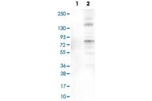 Western Blot analysis of Lane 1: negative control (vector only transfected HEK293T cell lysate) and Lane 2: over-expression lysate (co-expressed with a C-terminal myc-DDK tag in mammalian HEK293T cells) with ACSL5 monoclonal antibody, clone CL0275 .