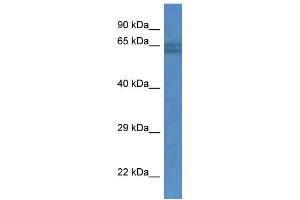 WB Suggested Anti-TRIM65 Antibody Titration: 1. (TRIM65 antibody  (C-Term))