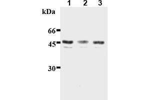 Western Blotting (WB) image for anti-Inhibitor of kappa Light Polypeptide Gene Enhancer in B-Cells, Kinase gamma (IKBKG) (AA 61-137) antibody (ABIN567773)