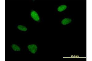Immunofluorescence of purified MaxPab antibody to FLJ10154 on HeLa cell. (ARGLU1 antibody  (AA 1-273))