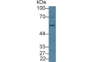 Western blot analysis of Rat Liver lysate, using Rat DRD2 Antibody (2 µg/ml) and HRP-conjugated Goat Anti-Rabbit antibody (