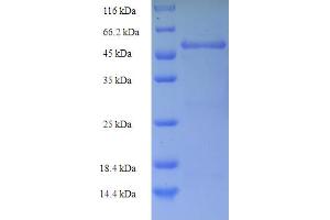 SDS-PAGE (SDS) image for Antigen Identified By Monoclonal Antibody Ki-67 (MKI67) (AA 3120-3256), (partial) protein (His tag) (ABIN5709935)