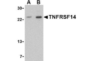Image no. 1 for anti-Tumor Necrosis Factor Receptor Superfamily, Member 14 (TNFRSF14) (N-Term) antibody (ABIN265160) (HVEM antibody  (N-Term))