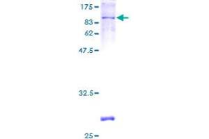 SDS-PAGE (SDS) image for phosphodiesterase 4D, cAMP-Specific (PDE4D) (AA 1-518) protein (GST tag) (ABIN1782353) (PDE4D Protein (AA 1-518) (GST tag))