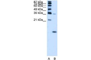 WB Suggested Anti-HBZ Antibody Titration:  1. (HBZ antibody  (N-Term))