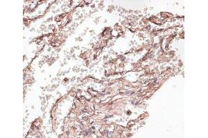 Immunohistochemistry of paraffin-embedded Human lung using COL6A1 Polyclonal Antibody at dilution of 1:100 (40x lens). (COL6A1 antibody)