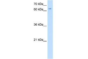 WB Suggested Anti-RBM35A Antibody Titration:  5.