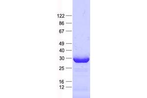Validation with Western Blot (MRPS15 Protein (His tag))
