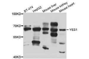Western blot analysis of extract of various cells, using YES1 antibody. (YES1 antibody)