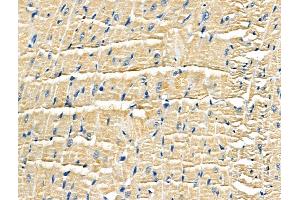 ABIN6259653 and ABIN6266917 at 1/100 staining Rat heart tissue by IHC-P. (Serotonin Receptor 5A antibody  (Internal Region))