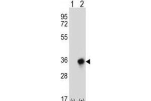 Western Blotting (WB) image for anti-Carbonyl Reductase 3 (CBR3) antibody (ABIN2997011)