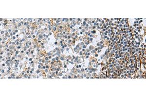 Immunohistochemistry of paraffin-embedded Human tonsil tissue using GLS Polyclonal Antibody at dilution of 1:70(x200) (Glutaminase antibody)
