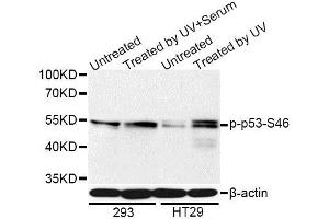 Western blot analysis of extracts of 293 and HT-29 cells, using Phospho-p53-S46 antibody (ABIN5969969) at 1/1000 dilution. (p53 antibody  (pSer46))