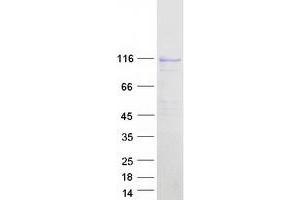 Validation with Western Blot