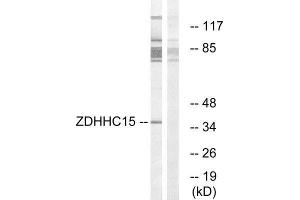 Western Blotting (WB) image for anti-Zinc Finger, DHHC-Type Containing 15 (ZDHHC15) (C-Term) antibody (ABIN1851773) (ZDHHC15 antibody  (C-Term))
