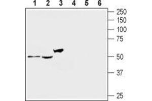 Western blot analysis of rat DRG (lanes 1 and 4), mouse brain (lanes 2 and 5) and human brain neuroblastoma SH-SY5Y (lanes 3 and 6) lysates: - 1-3. (HTR2A antibody  (Extracellular))