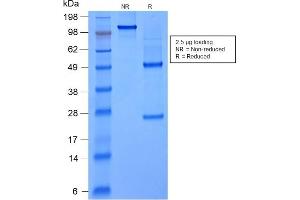 SDS-PAGE Analysis Purified FOXA1 Mouse Recombinant Monoclonal Antibody (rFOXA1/1515). (Recombinant FOXA1 antibody  (AA 372-472))