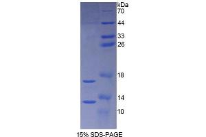SDS-PAGE analysis of Rat Synuclein alpha Protein. (SNCA Protein)