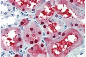 Human Kidney (formalin-fixed, paraffin-embedded) stained with GATA3 antibody ABIN462169 followed by biotinylated goat anti-rabbit IgG secondary antibody ABIN481713, alkaline phosphatase-streptavidin and chromogen. (GATA3 antibody  (AA 36-85))