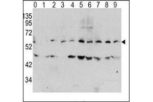 Western blot analysis of phospho c-Myc antibody and human TPA activated HeLa cells/lysate (0: without TPA; 1: 60ug/ml TPA-15min; 2: 60ug/ml-30min; 3: 60ug/ml-45min; 4: 125ug/ml-15min; 5: 125ug/ml-30min; 6: 125ug/ml-45min; 7: 250ug/ml-15min; 8: 250ug/ml-30