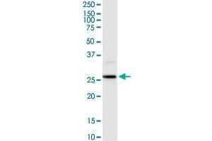 HOXB9 MaxPab rabbit polyclonal antibody. (HOXB9 antibody  (AA 1-250))