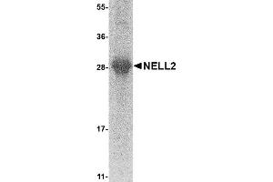 Western Blotting (WB) image for NEL-Like 2 (Chicken) (NELL2) (AA 22-238) protein (His tag) (ABIN2468886) (NELL2 Protein (AA 22-238) (His tag))