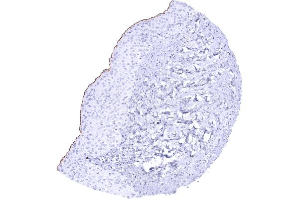 Uroplakin 3B antibody