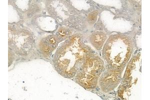 at 1/100 staining human normal kidney tissue by IHC-P. (PDE4B/C/D antibody)