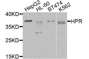 Western blot analysis of extracts of various cell lines, using HPR antibody (ABIN6003630) at 1/1000 dilution. (HPR antibody)