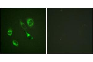 Immunofluorescence analysis of HeLa cells, using EPHA2/3/4 (Phospho-Tyr588/596) antibody. (EPHA2/3 antibody  (pTyr588, pTyr596))