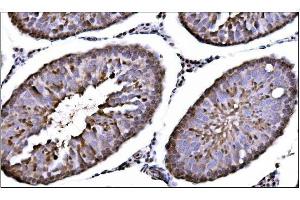 IHC analysis of CAMKIV/Camk4 using anti-CAMKIV/Camk4 antibody (ABIN7600419). (CAMK4 antibody  (AA 19-469))