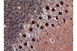 Immunohistochemistry (IHC) analysis of paraffin-embedded Human Brain, antibody was diluted at 1:100. (HSD11B1 antibody  (Internal Region))