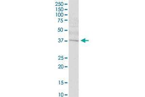 SETMAR MaxPab polyclonal antibody. (SETMAR antibody  (AA 1-352))