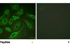 Immunofluorescence analysis of HeLa cells, using PLN polyclonal antibody . (Phospholamban antibody)